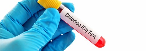 רמת כלור בדם (Chloride) - תמונה